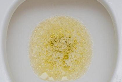 尿酸|47岁男子尿酸高达810,肾衰离世,医生:常喝1水,等于“自残”