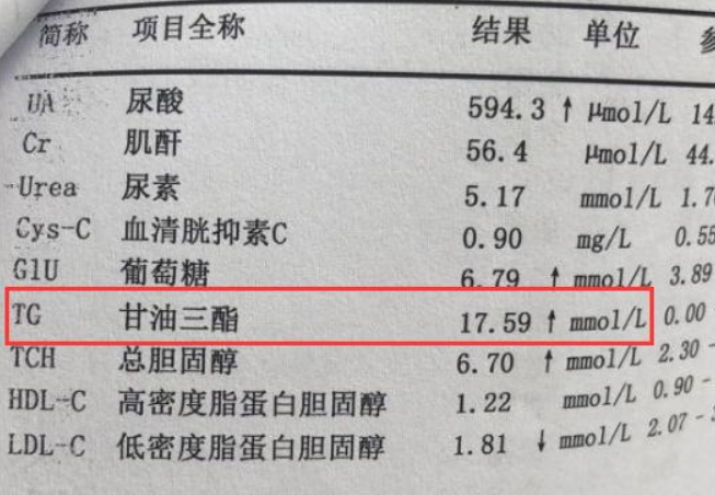 医生|高血脂不能吃坚果？多家医院声明：不想血管成“石头”，远离2物