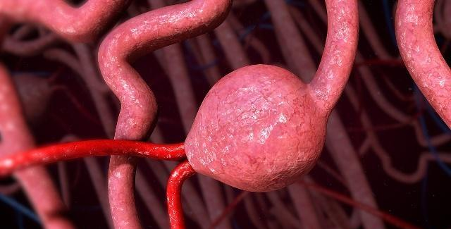 牛奶|长期尿蛋白对身体有什么影响?