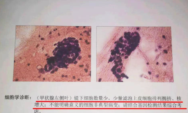 中药|90后夫妻双双患甲状腺癌,医生无奈:煮粥常放1“果”,简直胡闹