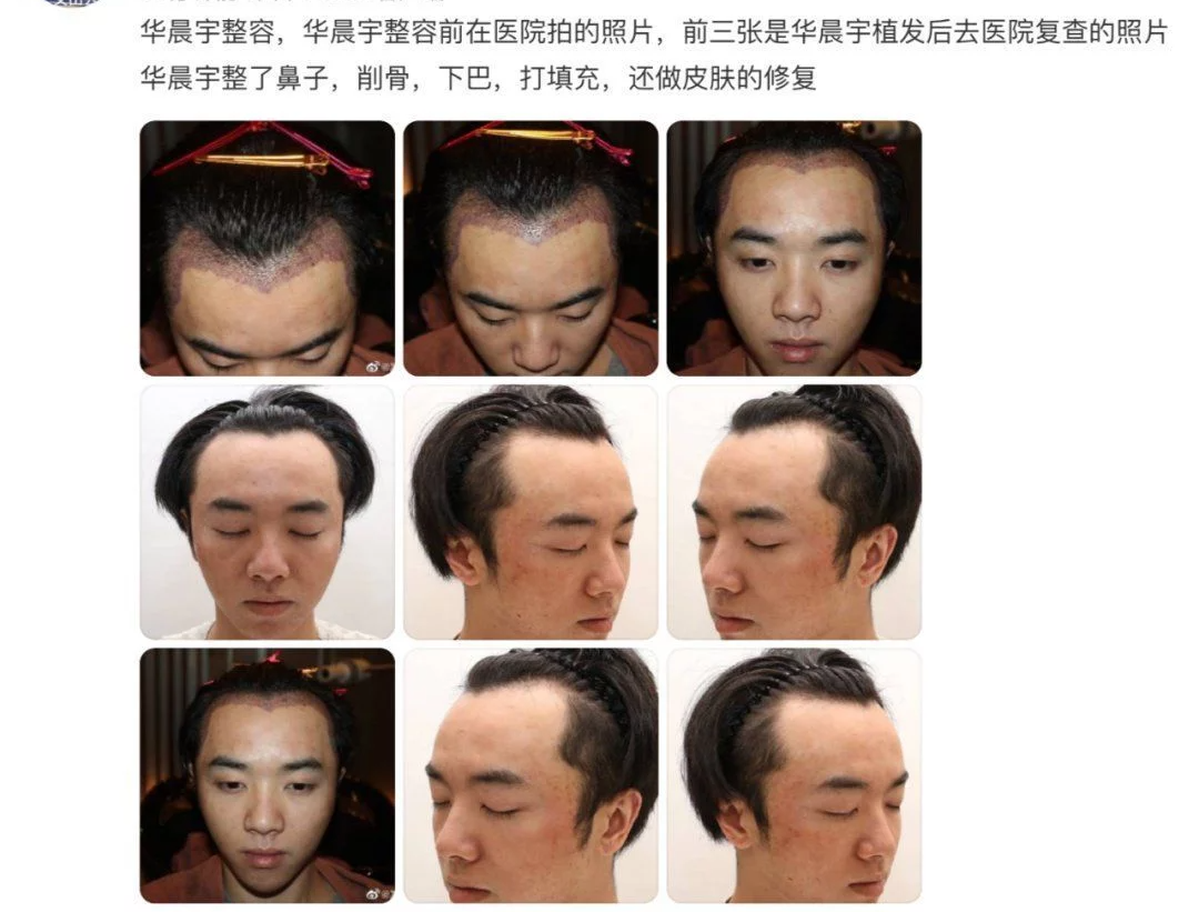 华晨宇|整容、疯癫、畸形造型，曾经的懵懂可爱的“火星男孩”华晨宇到底怎么了？