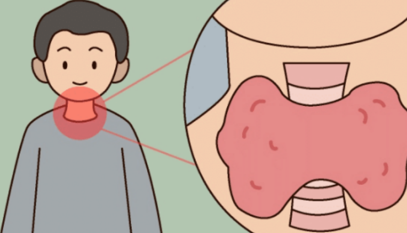 肉桂|夏季“散结冠军”已公布,黄瓜仅排第三,敞开吃,甲状腺或会感谢你