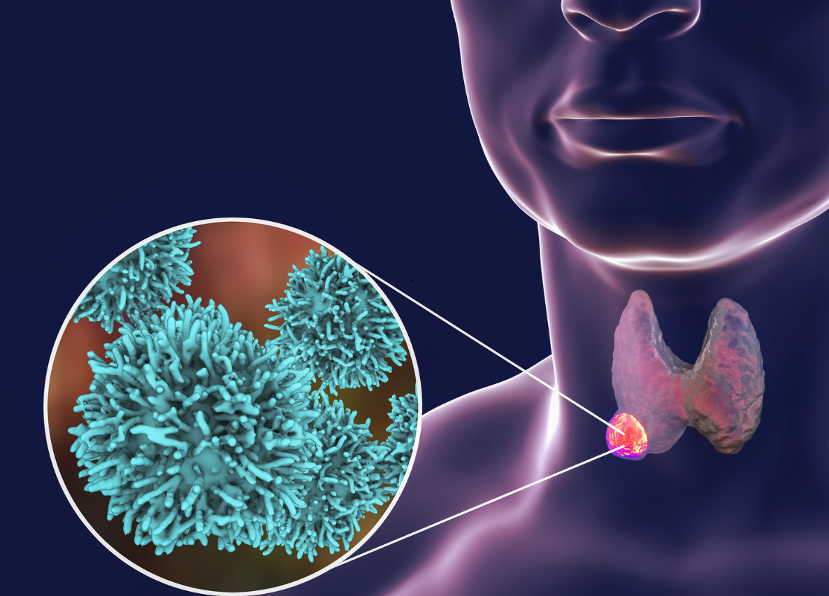 甲状腺|这3种蔬菜,或许比辛辣食物还伤甲状腺,告诉家人,一定要少吃