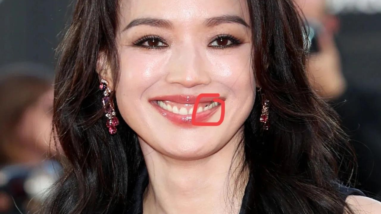 舒淇遭遇“牙齿乌龙”，红毯微笑露出“蛀牙”，尴尬掩饰引热议！