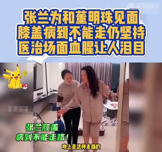 陈小纭|张兰膝盖受伤,画面曝光太吓人,积水严重红肿已无法正常行走