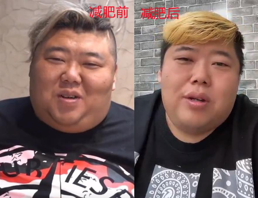 网红“胖猴仔”减肥后复胖，近照曝光遭嘲讽，网友：不如不减