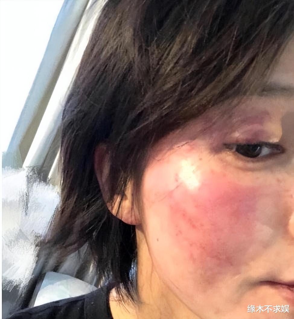 黄景瑜前妻再曝大瓜，控黄景瑜在姥姥丧期出轨，和女明星开房！