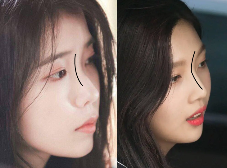 张雨绮的脸,怎么从千颂伊一夜间崩成蔡明了?