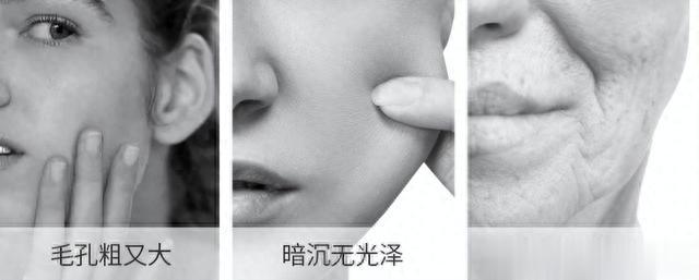 干皮对我们来说是一个考验，肌肤补水正确打开方式赶紧来学习！