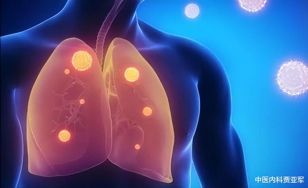 中药里的“散结王”,横扫一身结节、囊肿、息肉和肌瘤