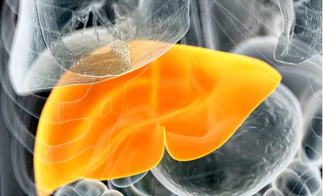 什么样的脂肪肝难以逆转？什么情况下会发展成肝硬化甚至肝癌？