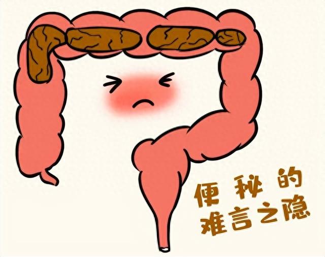 振动胶囊系电子药,进入肠道振动治疗便秘