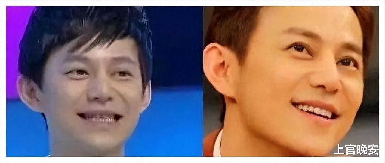 没眼看!嘴包不住牙,嘴凸,演戏难看,明星能不能放弃烤瓷牙审美