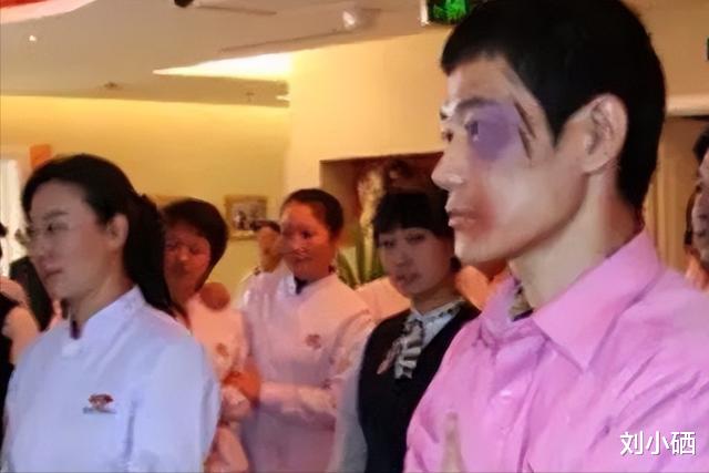 |矢野浩二被打得满脸青紫，道歉求原谅，网友：我们不接受！