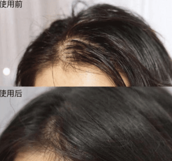 再见沙宣、海飞丝！国产再火一款新型洗发水，这次真的良心了