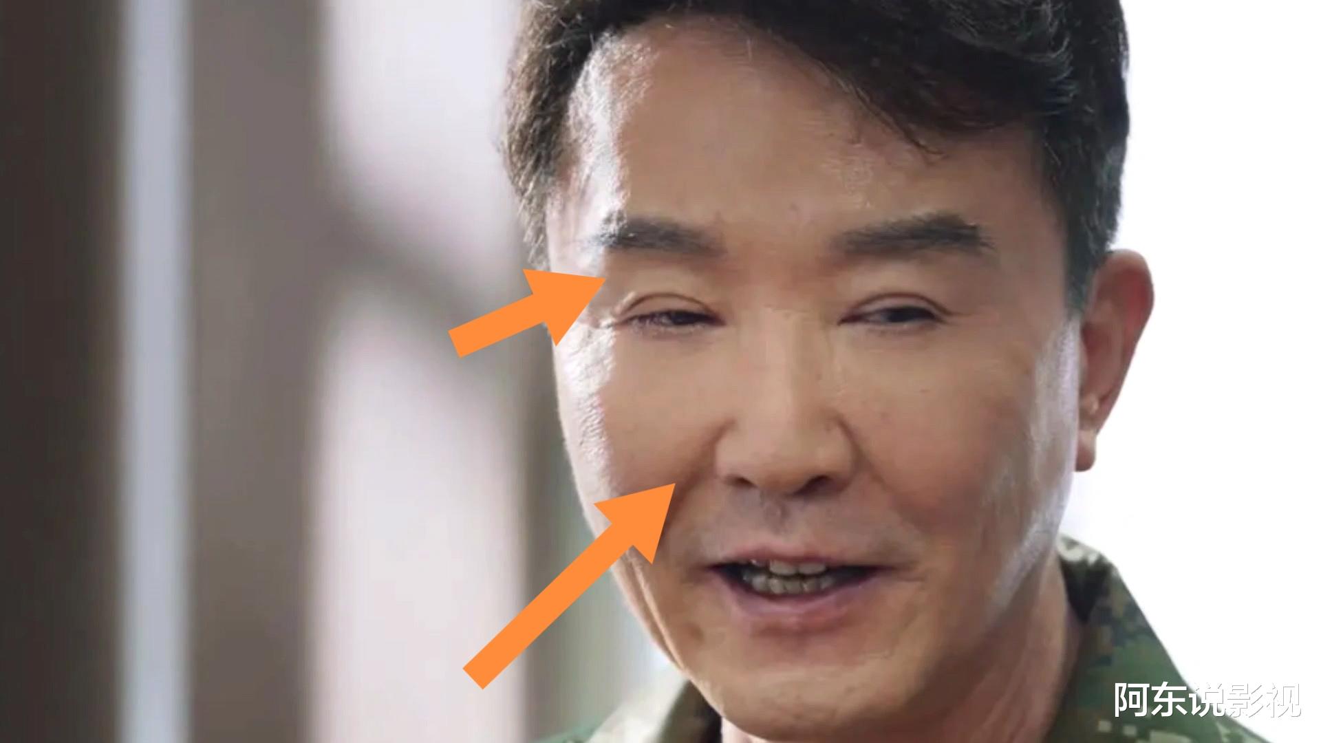 当硅胶脸混进职业剧，《他从火光中走来》的败笔演员，换掉就好了
