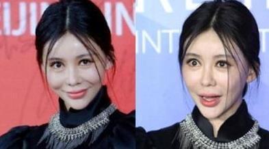 宁静扎900针,倪萍鼻孔外翻,明星里的打针族,掀开了娱圈遮羞布