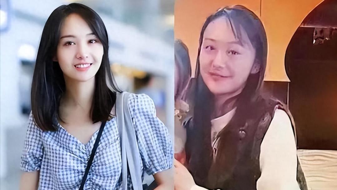 有种“整容”叫郑爽退网，被封杀两年后，她发胖秃头就像换了个人！