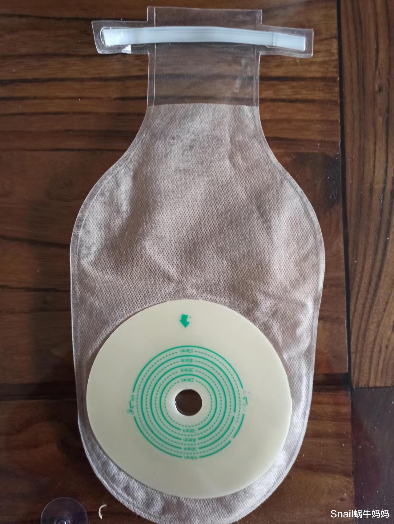 我58岁,患癌一年半,挂粪袋生活6个月,3进手术室,如今笑对人生