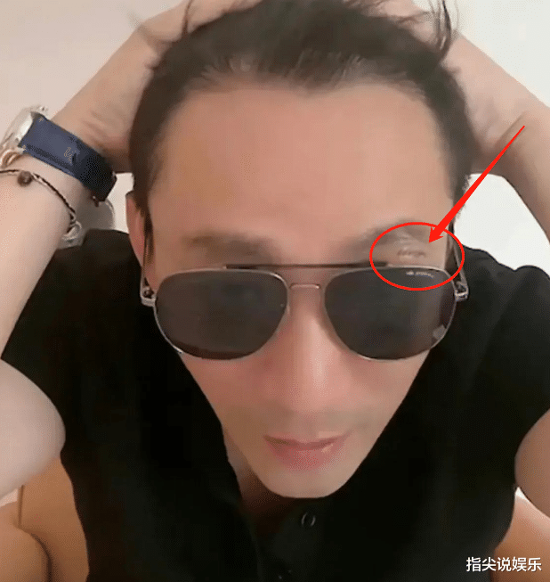 汪小菲受伤原因曝光，直播心不在焉引担忧，张兰称真相可怕不能说