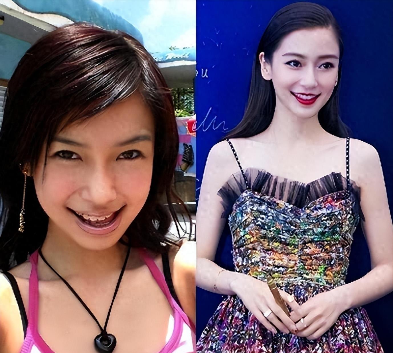 有种顽强叫“我没整容”!明明从大饼脸变成V脸,真当观众看不见