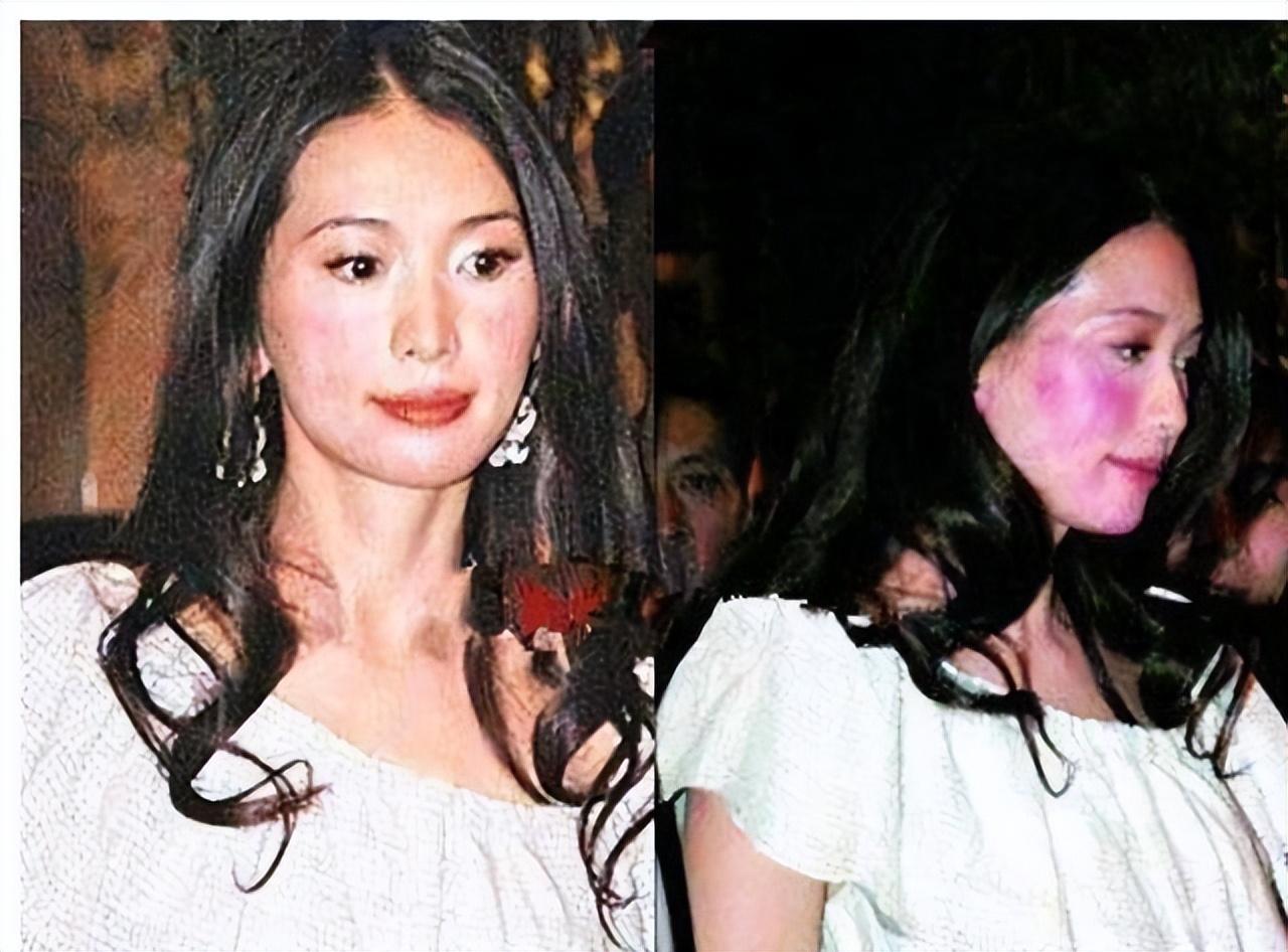 口水能过敏，天生没子宫，这6位明星的“隐疾”，有钱也治不好