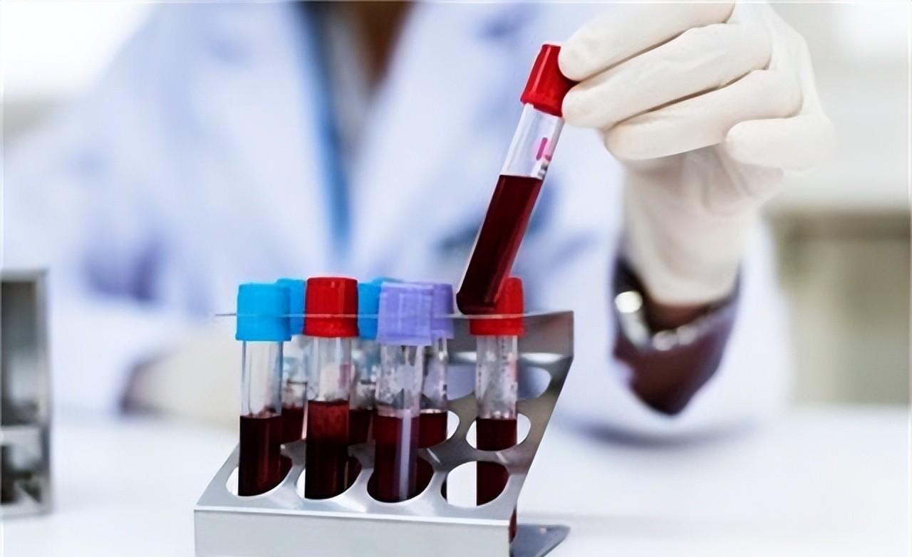 |尿酸高全身都受损,出现3种表现,可能是你尿酸高了,及时控制