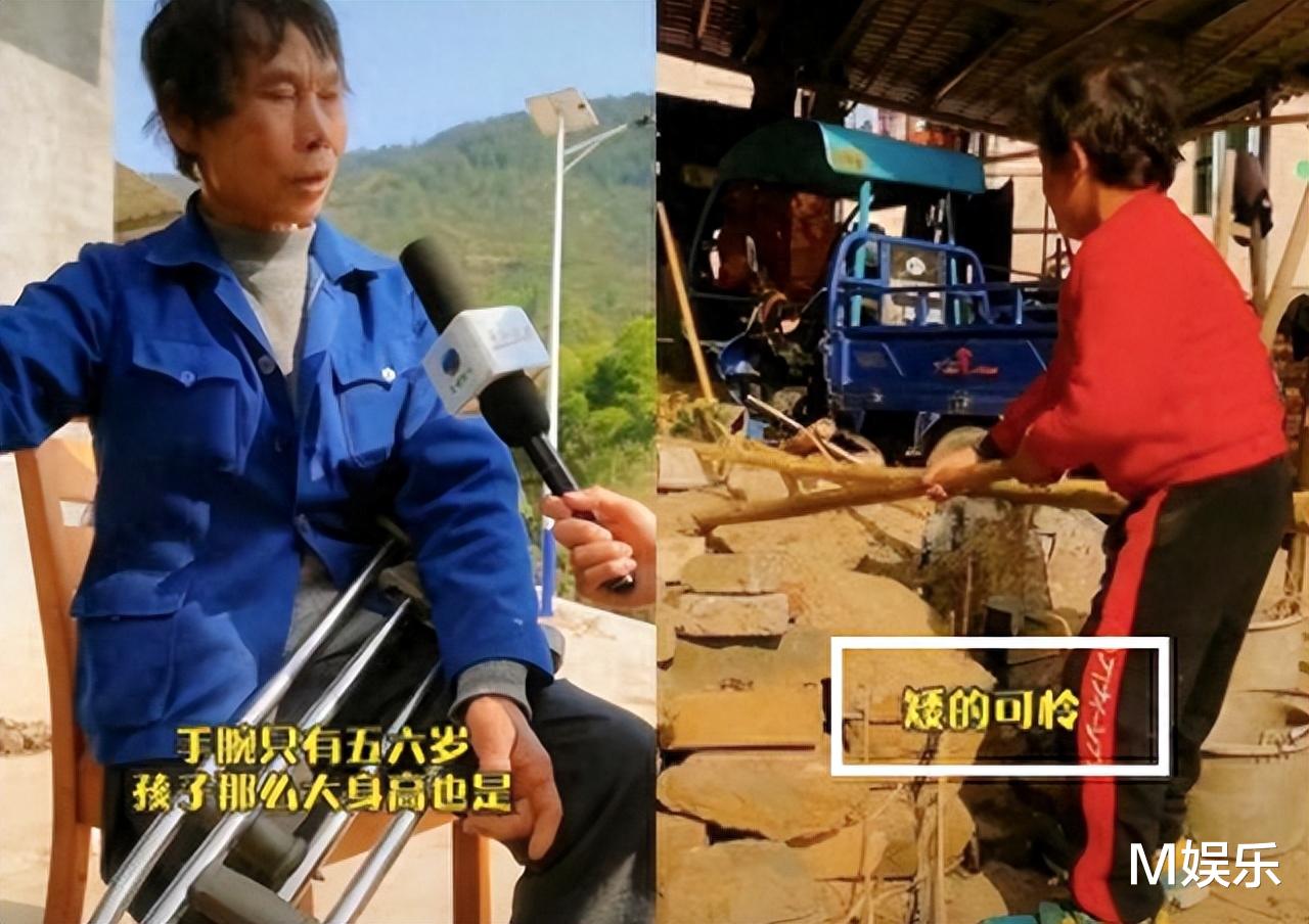 被注射抑生长剂，皮肤溃烂无人管，这4位童星，真的被父母害惨了