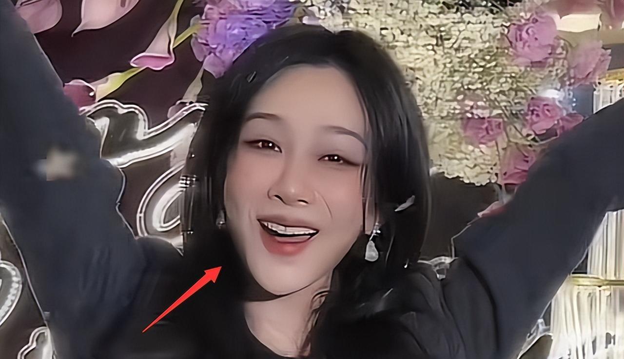 杨紫庆生照曝光，外貌大变引发整容质疑