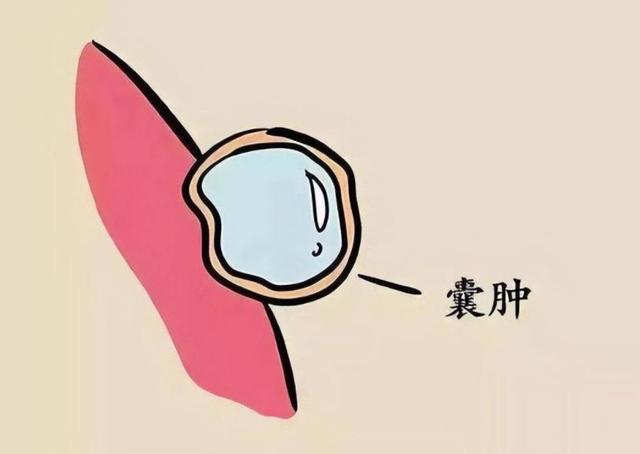 芹菜是结节的“加速剂”？医生提醒：不想结节癌变，尽量少吃4物