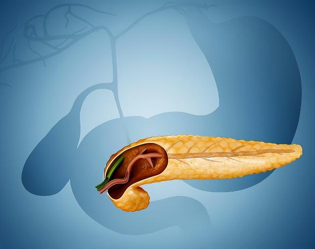 口腔溃疡|45岁男子每天大便两三次，确诊胰腺癌！4种异常或是身体“警报”