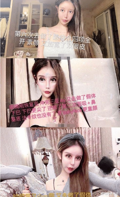 上海00后整容狂人:4年花600万“削骨”,如今模样大变还泪腺失控