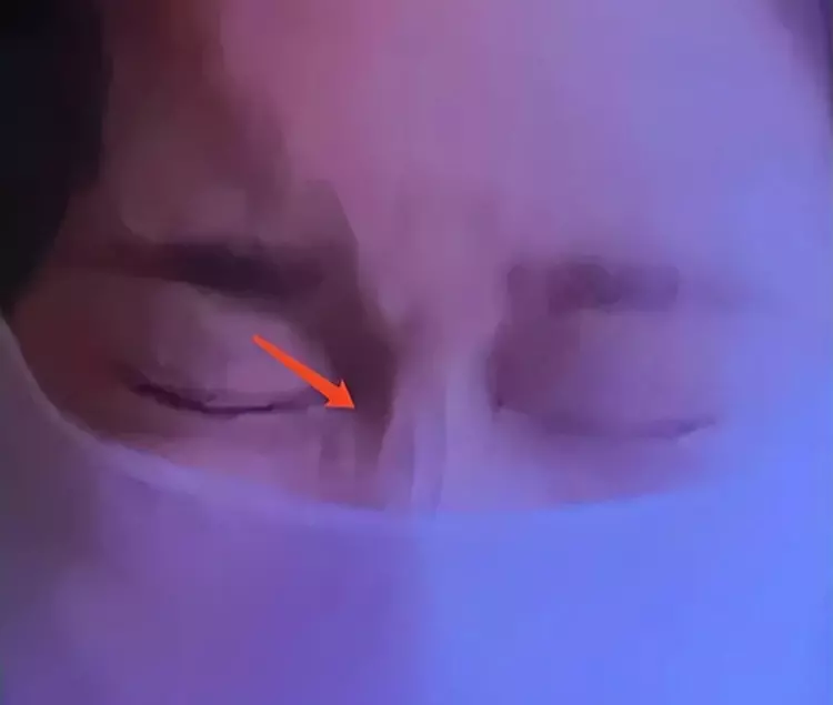 明星|出道后去“动脸”,“换了头”还称纯天然,这些明星不羞吗?