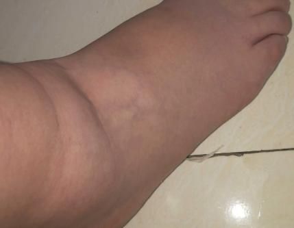 肝脏|伤肝的4种行为,奉劝大家尽早戒掉!