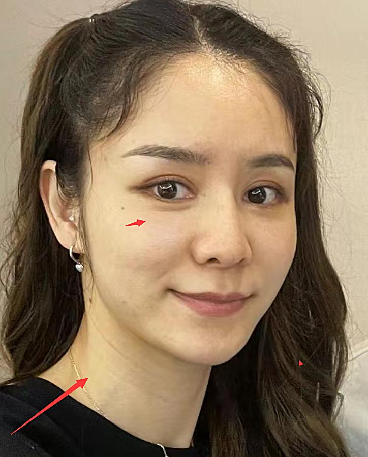 林峰妻子张馨月生照片曝光,毛孔粗大老10岁,和林峰发际线双双上移