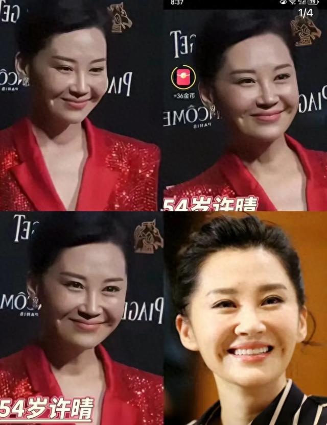 许晴久违现身大变样:脸部好似充气肿成单眼皮,硅胶感十足