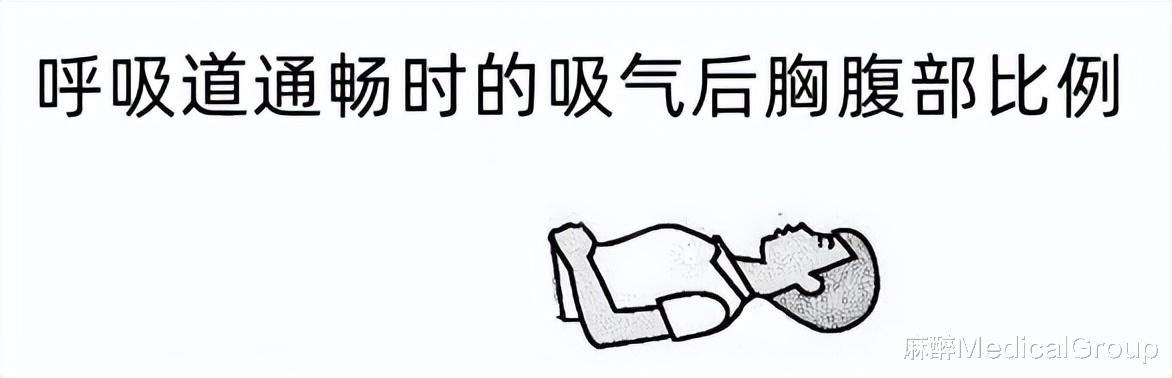 |【经验分享】延迟性呼吸抑制致“呼吸反常”