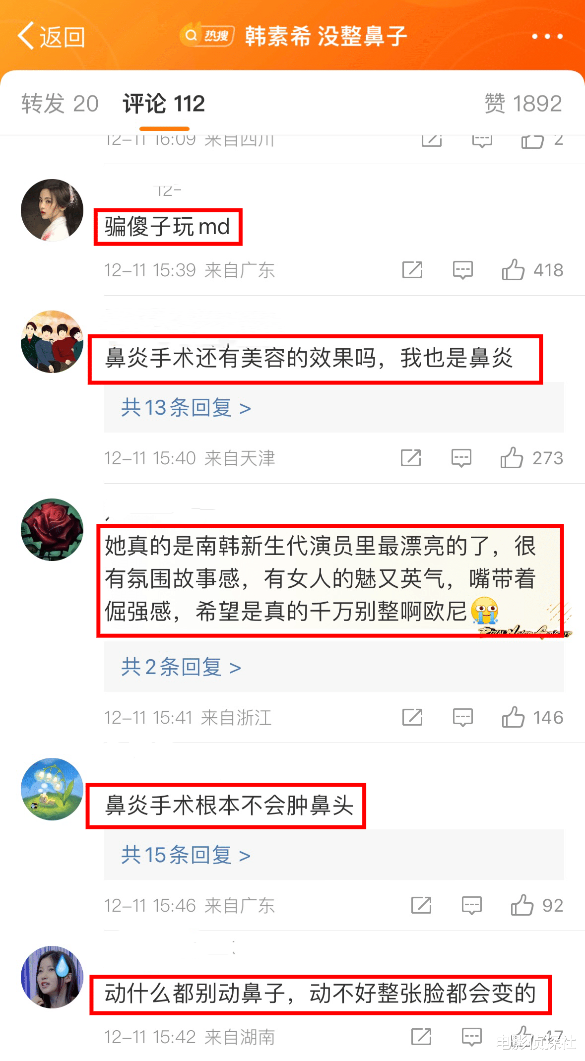 韩素希否认整容!直言是做了鼻炎手术还没消肿,网友并不买账