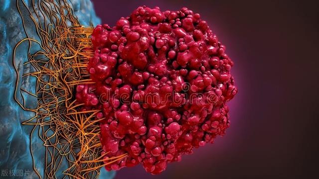 身上的痣有好不好？提醒：若“黑痣”长在这4个部位，请多注意