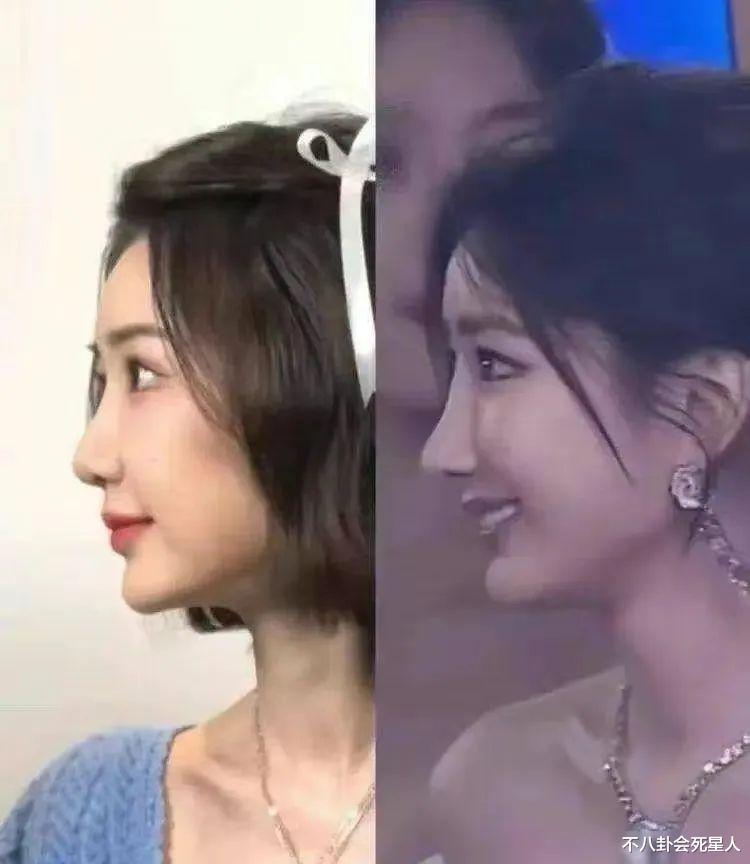 娱乐圈假鼻子扎堆,金晨新剧出戏,毛晓彤变样,把我看无语了