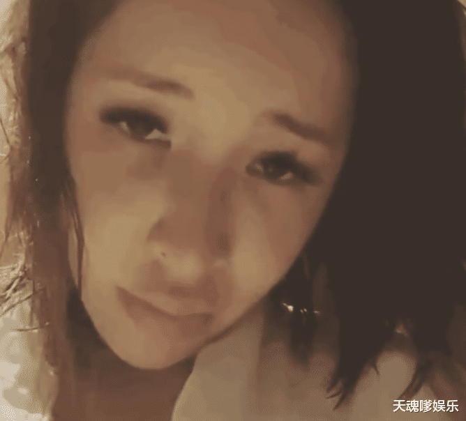 萧亚轩被狗咬伤未痊愈，嘴部下巴严重变形，披头散发疑抑郁症复发