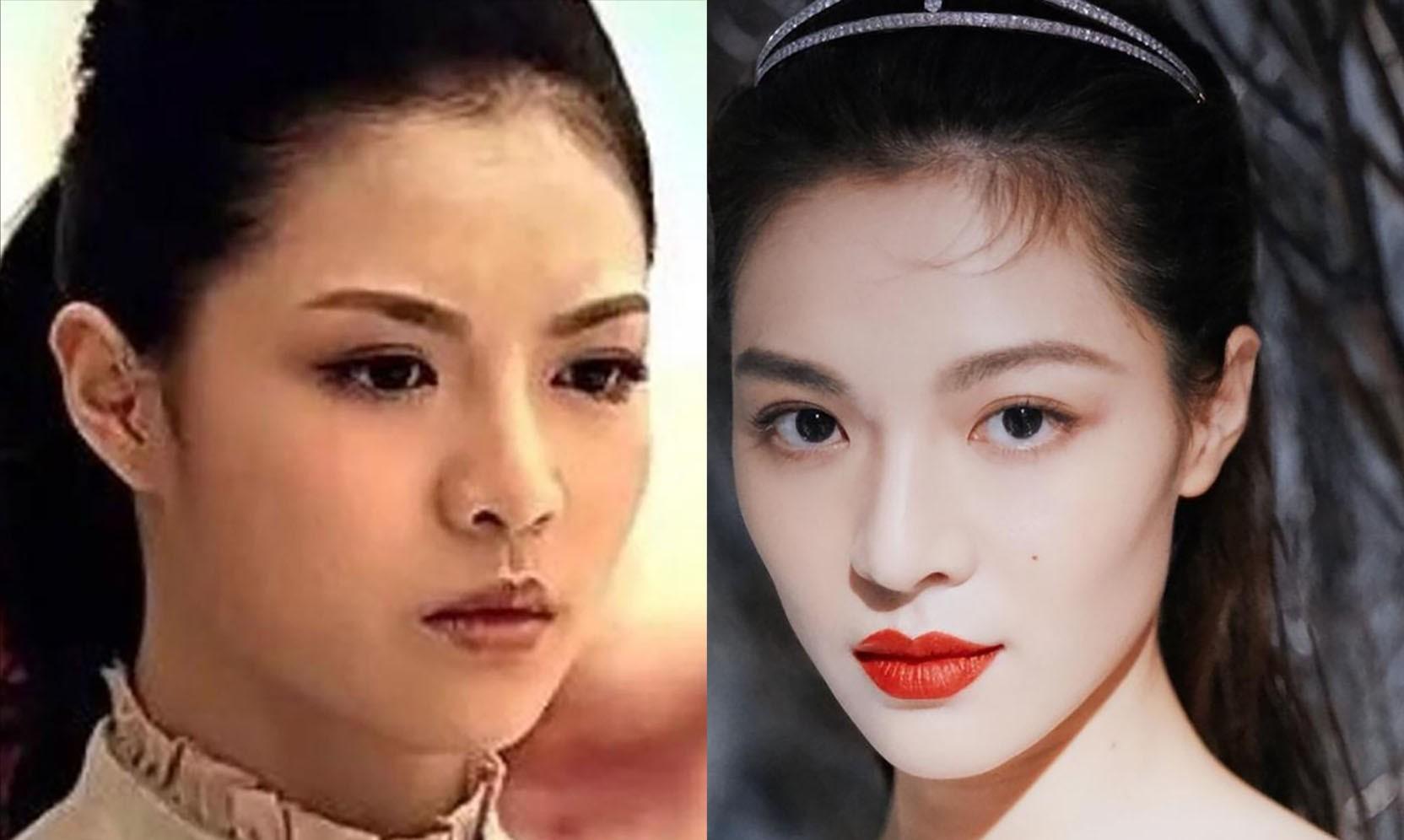 明明是整容脸,却成了颜值巅峰,这9位女星,动脸太成功了