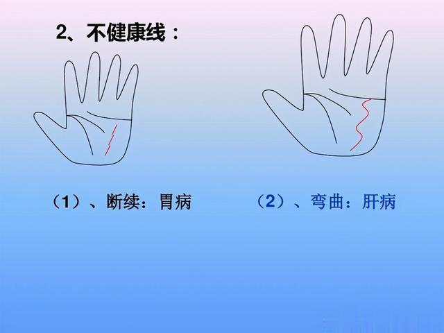 最全手诊图谱,一看就懂,简单实用!不出门也能望手察病!收了吧
