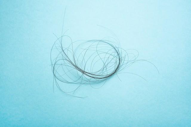 孙燕|洗澡时“那里”的毛总是容易脱落是怎么回事？忠告：或有4个危害