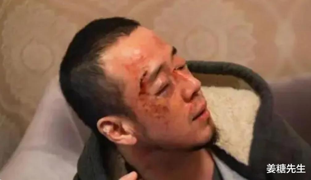 “杨坤被打”上热搜,他的回应像一个笑话,网友:真不怪刀郎!