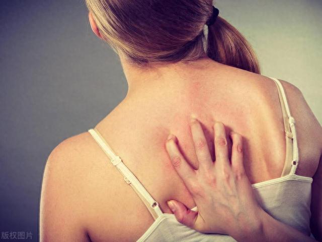 以为是皮肤病，结果可能是癌？身体4个部位发“痒”，趁早检查！