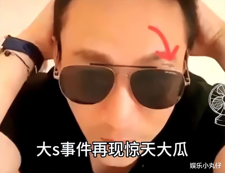 汪小菲深夜约会低胸辣妹，右眼大片淤青似熊猫，女方颜值神似大S