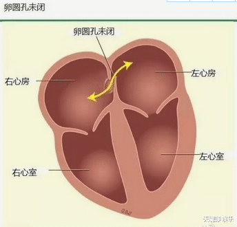 周群|知名主持人周群紧急入院做心脏手术,躺床憔悴插满管,曝术中心慌