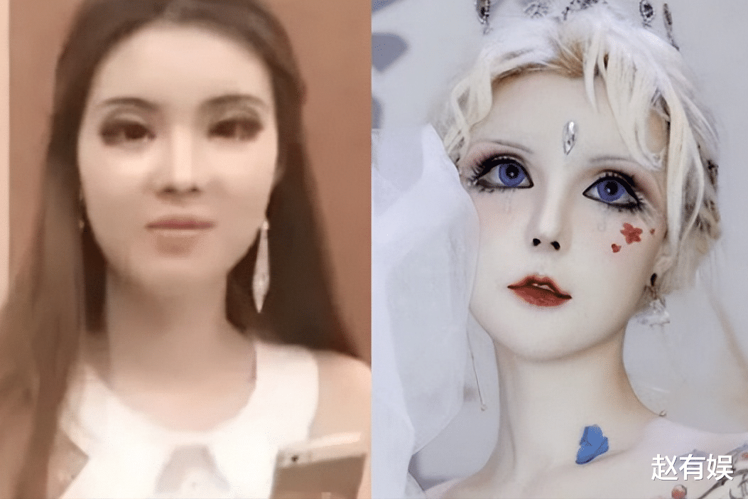 整容|脸上动刀108次，不敢张嘴吃饭，坚称没有整容，这个女孩还有救吗