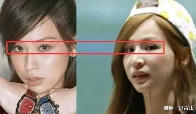 王心凌|曝王心凌生图变化大，医美脸又僵又肿，商演费52万被指捞金无下限